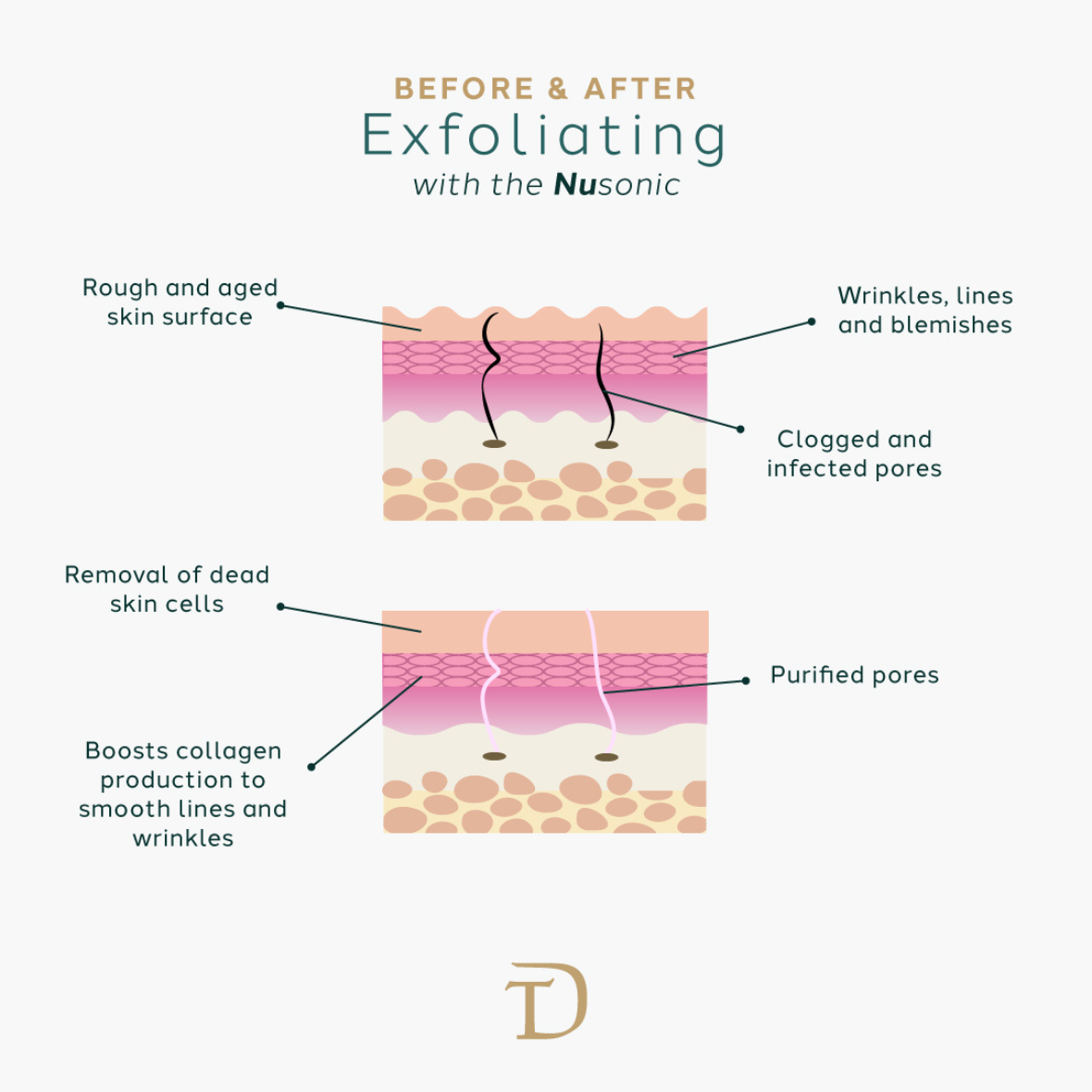 NuSonic Facial Exfoliating Device — Sonic Cleansing & Skin Renewal