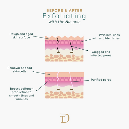 NuSonic Facial Exfoliating Device — Sonic Cleansing & Skin Renewal